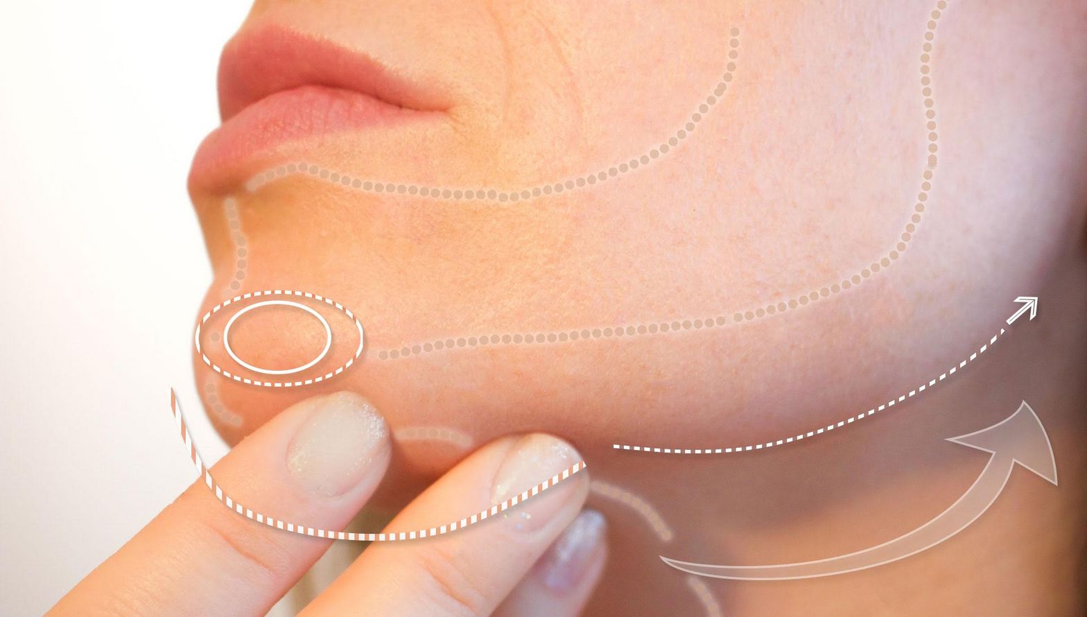 Kinn angeschwollen unterm Lymphknoten unterm