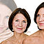 facelift