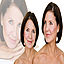 facelift